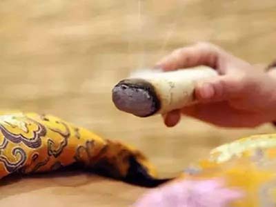 阴盛冬季咋保健 中医火灸祛风寒 - 血管微语-血管微语