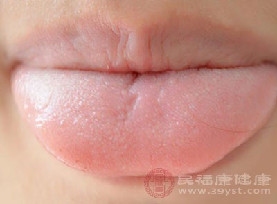 脾不好舌先知 舌头上的哪些特征暗示脾虚了 - 血管微语-血管微语