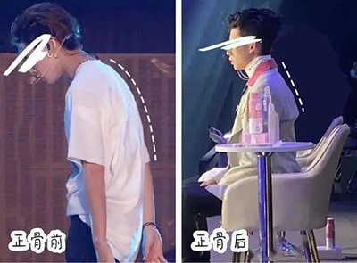 正骨要有“咔嚓”“咯吱”“嘎嘣脆”的响声才算正骨吗？-血管微语