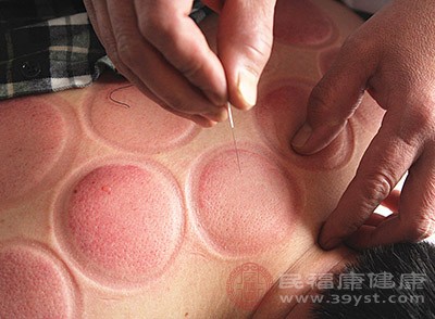 针灸的危害 针灸的方法不对会引起这个问题-血管微语