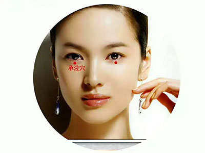 揉按承泣穴缓解眼疲劳 - 血管微语-血管微语