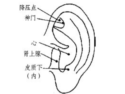耳穴压豆巧治排尿困难 - 血管微语-血管微语