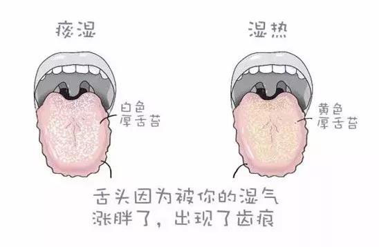 3月雨多湿气重 健脾祛湿除百病-血管微语