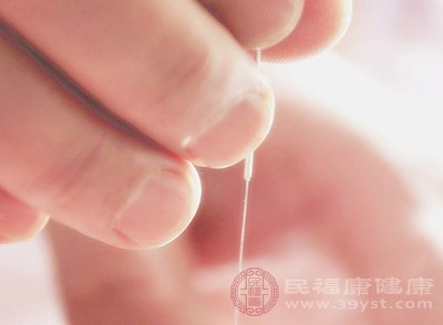 针灸的功效 想不到针灸可以治疗这个病 - 血管微语-血管微语